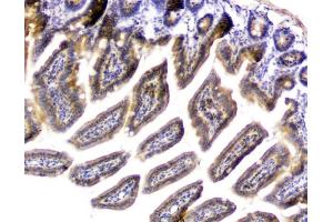 IHC analysis of PPCS using anti-PPCS antibody (ABIN6719631).