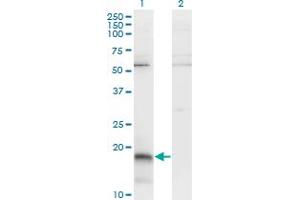 Western Blot analysis of PAEP expression in transfected 293T cell line by PAEP monoclonal antibody (M01), clone 6G2. (PAEP Antikörper  (AA 53-162))