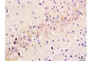 Formalin-fixed and paraffin embedded: rat brain tissue labeled with Anti-GAP-43 Polyclonal Antibody, Unconjugated  at 1:300 followed by conjugation to the secondary antibody and DAB staining (GAP43 Antikörper  (AA 9-100))