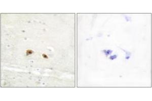 Immunohistochemistry analysis of paraffin-embedded human brain tissue, using EGR3 Antibody. (EGR3 Antikörper  (AA 338-387))