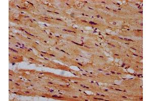 IHC image of ABIN7149034 diluted at 1:600 and staining in paraffin-embedded human heart tissue performed on a Leica BondTM system. (CSAD Antikörper  (AA 344-493))