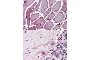 Immunohistochemical staining of formalin-fixed, paraffin-embedded human skeletal muscle (A) and human brain (B), cerebellum tissue after heat-induced antigen retrieval. (NEK7 Antikörper  (N-Term))