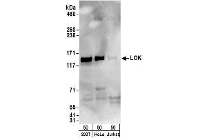 anti-Serine/threonine Kinase 10 (STK10-A) (AA 350-400) antibody