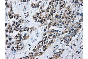 Immunohistochemical staining of paraffin-embedded Kidney tissue using anti-ACO2mouse monoclonal antibody. (ACO2 Antikörper)