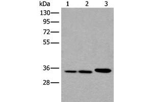 Western blot analysis of A549 Hela and K562 cell lysates using RPF2 Polyclonal Antibody at dilution of 1:400 (RPF2 Antikörper)