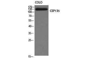 Western Blotting (WB) image for anti-Centrosomal Protein 135kDa (CEP135) (C-Term) antibody (ABIN3183857) (CEP135 Antikörper  (C-Term))