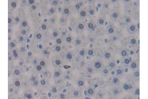 Immunohistochemistry (IHC) image for anti-Protein tyrosine Phosphatase, Receptor Type, J (PTPRJ) (AA 1033-1277) antibody (ABIN5014202)