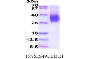 SDS-PAGE (SDS) image for CD48 (CD48) (AA 27-220) protein (His tag) (ABIN7281272) (CD48 Protein (CD48) (AA 27-220) (His tag))