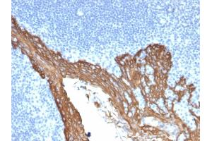 Formalin-fixed, paraffin-embedded human Prostate stained with Cytokeratin 8 Mouse Monoclonal Antibody (KRT8/2115).