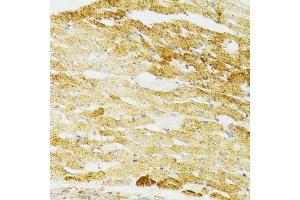 Immunohistochemistry (Paraffin-embedded Sections) (IHC (p)) image for anti-Heat Shock 70kDa Protein 9 (Mortalin) (HSPA9) (AA 380-679) antibody (ABIN3021000)