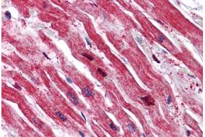 Human Heart: Formalin-Fixed, Paraffin-Embedded (FFPE) (SRPX Antikörper  (N-Term))