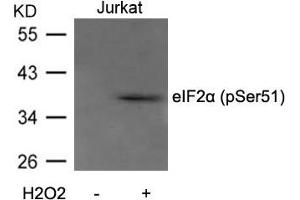Western blot analysis of extracts from Jurkat cells untreated or treated with H2O2 using eIF2a(Phospho-Ser51) Antibody. (EIF2S1 Antikörper  (pSer51))