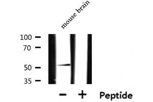 CXCR7 Antikörper  (Internal Region)