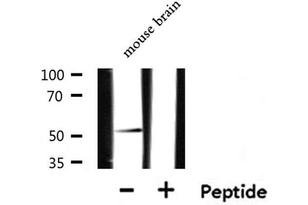 CXCR7 Antikörper  (Internal Region)