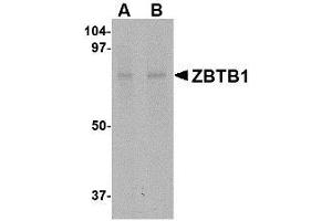 Image no. 1 for anti-Zinc Finger and BTB Domain Containing 1 (ZBTB1) (Internal Region) antibody (ABIN341710)