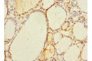Immunohistochemistry of paraffin-embedded human thyroid tissue using ABIN7171504 at dilution of 1:100 (TAPBPL Antikörper  (AA 201-468))