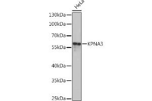 Western blot analysis of extracts of HeLa cells, using KPN Rabbit pAb  at 1:1000 dilution. (KPNA3 Antikörper  (AA 1-210))