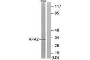 Western Blotting (WB) image for anti-Replication Protein A2, 32kDa (RPA2) (AA 10-59) antibody (ABIN2888859) (RPA2 Antikörper  (AA 10-59))
