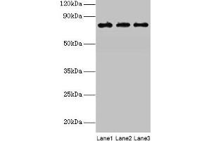 Western blot All lanes: KIRREL2 antibody at 8 μg/mL Lane 1: Mouse gonadal tissue Lane 2: Mouse lung tissue Lane 3: Mouse heart tissue Secondary Goat polyclonal to rabbit IgG at 1/10000 dilution Predicted band size: 76, 68, 62, 24 kDa Observed band size: 76 kDa (KIRREL2 Antikörper  (AA 21-219))