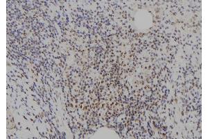 ABIN6273721 at 1/100 staining Human spleen tissue by IHC-P. (E2F8 Antikörper  (C-Term))