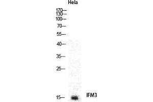 Western Blot (WB) analysis of specific cells using IFITM3 Polyclonal Antibody. (IFITM3 Antikörper  (N-Term))