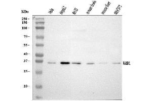 Western blot analysis of Dexras1/RASD1 using anti-Dexras1/RASD1 antibody (ABIN7599211).