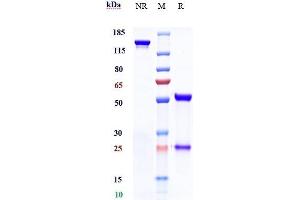 Anti-TROP2 Reference Antibody (sacituzumab) on SDS-PAGE under reducing (R) condition. (Rekombinanter Trop2 (Sacituzumab Biosimilar) Antikörper)