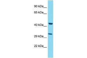 Western Blotting (WB) image for anti-Myb/SANT-Like DNA-Binding Domain Containing 4 with Coiled-Coils (MSANTD4) (N-Term) antibody (ABIN2791619) (MSANTD4 Antikörper  (N-Term))