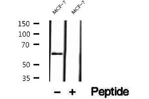 Western blot analysis of extracts of MCF-7 cells, using P4HA2 antibody. (P4HA2 Antikörper  (Internal Region))