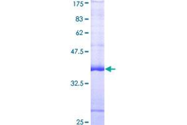 FRK Protein (AA 391-505) (GST tag)