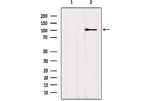 Western blot analysis of extracts from MCF7, using MYOCD Antibody. (Myocardin Antikörper  (Internal Region))