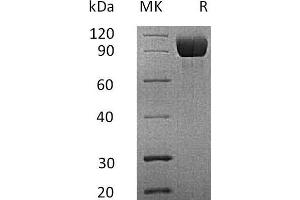 Western Blotting (WB) image for Interleukin 13 Receptor, alpha 1 (IL13RA1) protein (Fc Tag) (ABIN7320818) (IL13 Receptor alpha 1 Protein (Fc Tag))