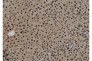 ABIN6263520 and ABIN6273271 at 1/100 staining Rat liver tissue by IHC-P. (NAT10 Antikörper  (Internal Region))