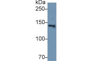 Western Blot; Sample: Human Serum; Primary Ab: 2µg/ml Rabbit Anti-Human HYOU1 Antibody Second Ab: 0. (150 kDa Oxygen Regulated Protein (AA 695-994) Antikörper)