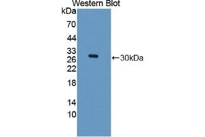 Western blot analysis of the recombinant protein. (ROCK1 Antikörper  (AA 1094-1323))