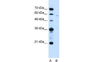WB Suggested Anti-MGC39633 Antibody Titration:  1.