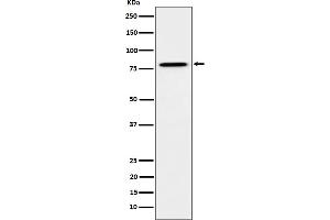 Western blot analysis of MUTA expression in HeLa cell lysate. (Rekombinanter MUT Antikörper)