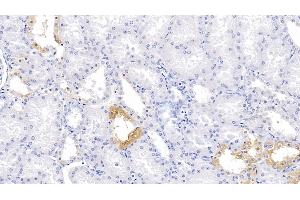 Detection of PBRM1 in Human Kidney Tissue using Polyclonal Antibody to Polybromo 1 (PBRM1) (Polybromo 1 Antikörper  (AA 1-306))