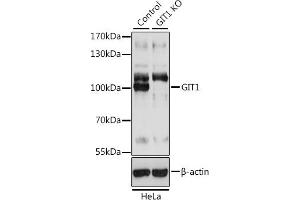 Western blot analysis of extracts from normal (control) and GIT1 knockout (KO) HeLa cells, using GIT1 antibody (ABIN7267383) at 1:3000 dilution. (GIT1 Antikörper  (AA 460-640))