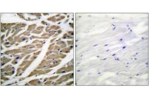 Immunohistochemistry analysis of paraffin-embedded human heart tissue, using Sodium Channel-pan Antibody. (Sodium Channel Antikörper  (AA 1466-1515))