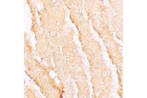 Immunohistochemistry (IHC) image for anti-Vacuolar Protein Sorting 39 Homolog (VPS39) (C-Term) antibody (ABIN1030796) (VPS39 Antikörper  (C-Term))