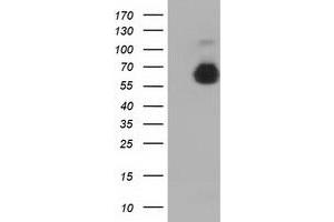 HEK293T cells were transfected with the pCMV6-ENTRY control (Left lane) or pCMV6-ENTRY AFP (Right lane) cDNA for 48 hrs and lysed. (alpha Fetoprotein Antikörper)