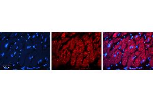Rabbit Anti-INSR Antibody   Formalin Fixed Paraffin Embedded Tissue: Human heart Tissue Observed Staining: Cytoplasmic Primary Antibody Concentration: 1:100 Other Working Concentrations: 1:600 Secondary Antibody: Donkey anti-Rabbit-Cy3 Secondary Antibody Concentration: 1:200 Magnification: 20X Exposure Time: 0. (Insulin Receptor Antikörper  (Middle Region))