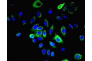 Immunofluorescent analysis of A549 cells using ABIN7158086 at dilution of 1:100 and Alexa Fluor 488-congugated AffiniPure Goat Anti-Rabbit IgG(H+L) (LRRN2 Antikörper  (AA 201-500))