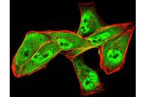 Immunocytochemistry (ICC) image for anti-Aldehyde Dehydrogenase 6 Family, Member A1 (ALDH6A1) (AA 1-195) antibody (ABIN5856297) (ALDH6A1 Antikörper  (AA 1-195))