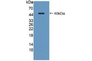 Western blot analysis of recombinant Human C8g. (C8G Antikörper  (AA 39-202))