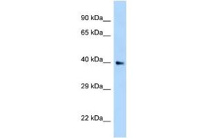 WB Suggested Anti-AIDA Antibody Titration: 1.