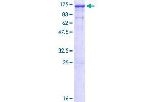 DNAJC6 Protein (AA 1-913) (GST tag)