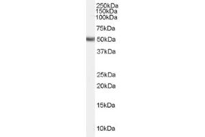 Image no. 1 for anti-Fatty Acid Desaturase 1 (FADS1) (Internal Region) antibody (ABIN374860) (FADS1 Antikörper  (Internal Region))