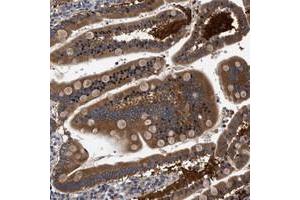 Immunohistochemical staining of human duodenum with FAM185A polyclonal antibody  strong cytoplasmic positivity in glandular cells at 1:50-1:200 dilution. (FAM185A Antikörper)